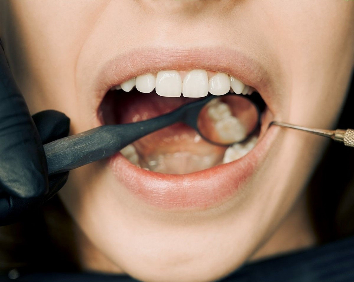 Paciente revision dientes boca pexels arvind philomin 12148417