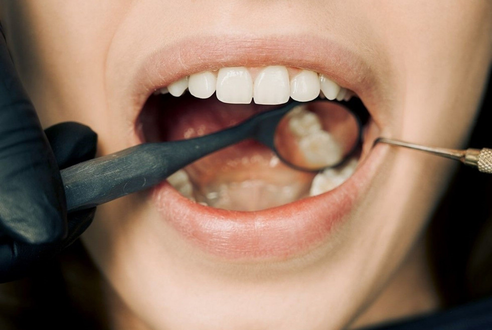 Paciente revision dientes boca pexels arvind philomin 12148417