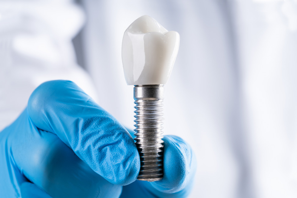 Imagen implantes DENTAID UIC