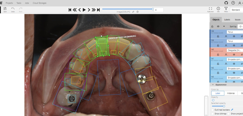 Fig.004 mydentist casoIA dm83