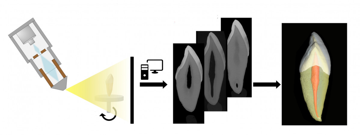 Microtomografia axial computarizada