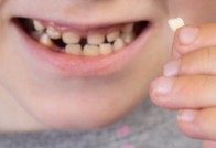 Niño caries tea Sermade