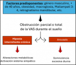 Figura 1 opinion Ana Boquete dm92