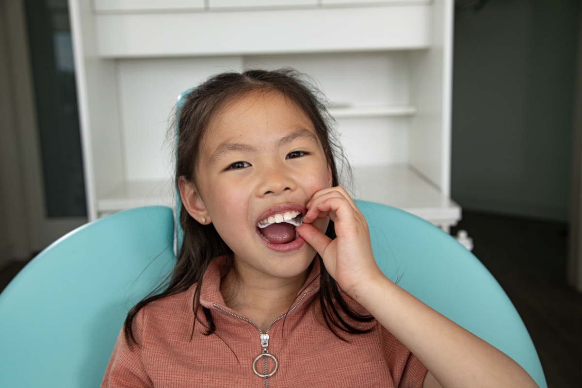 Invisalign® Palatal Expande 2