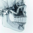 Radiodiagnostico con IA