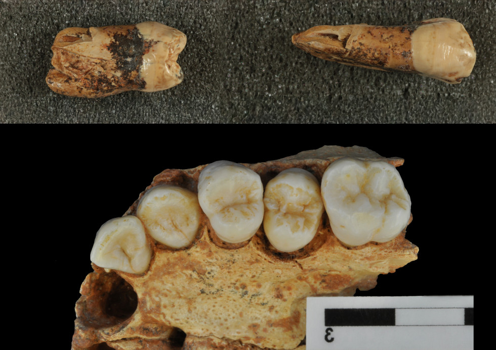 Premolares y maxilar de Homo antecessor