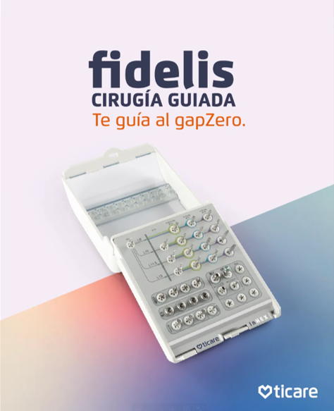 TICARE Fidelis Cirugia guiada