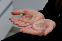 Alineadores transparentes pexels itslauravillela 28407748