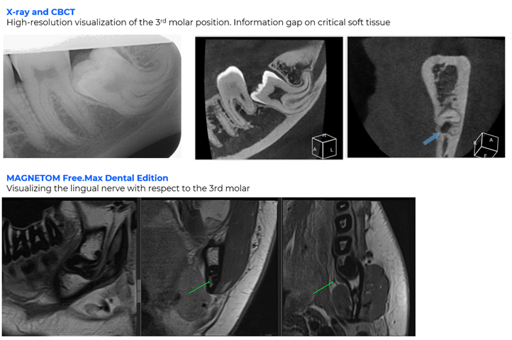 CTS Fig 3 ddMRI clinical images