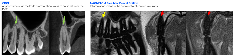 CTS Fig 2 ddMRI clinical images