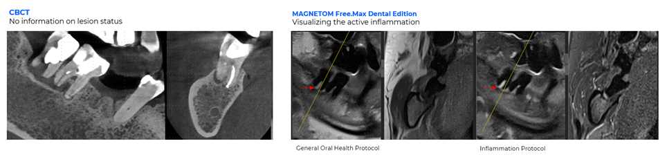 CTS Fig 1 ddMRI clinical images