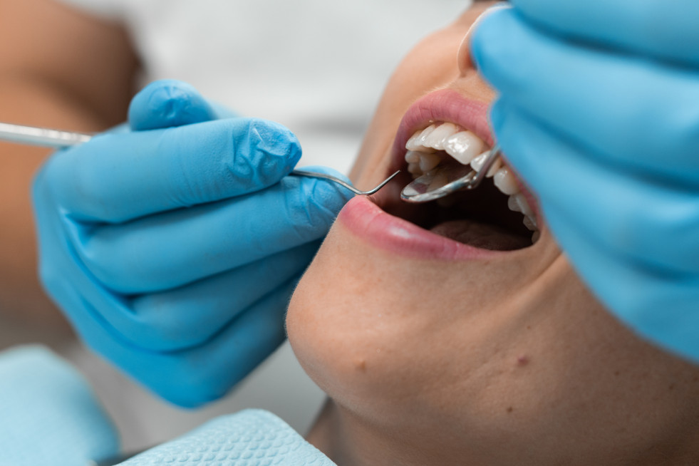 Encias periodontitis iStock 2151134310