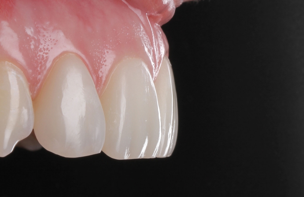 Cerec Primemill asegura la producción de restauraciones de alta calidad con márgenes muy precisos y una superficie muy lisa. FOTO: Dentsply Sirona