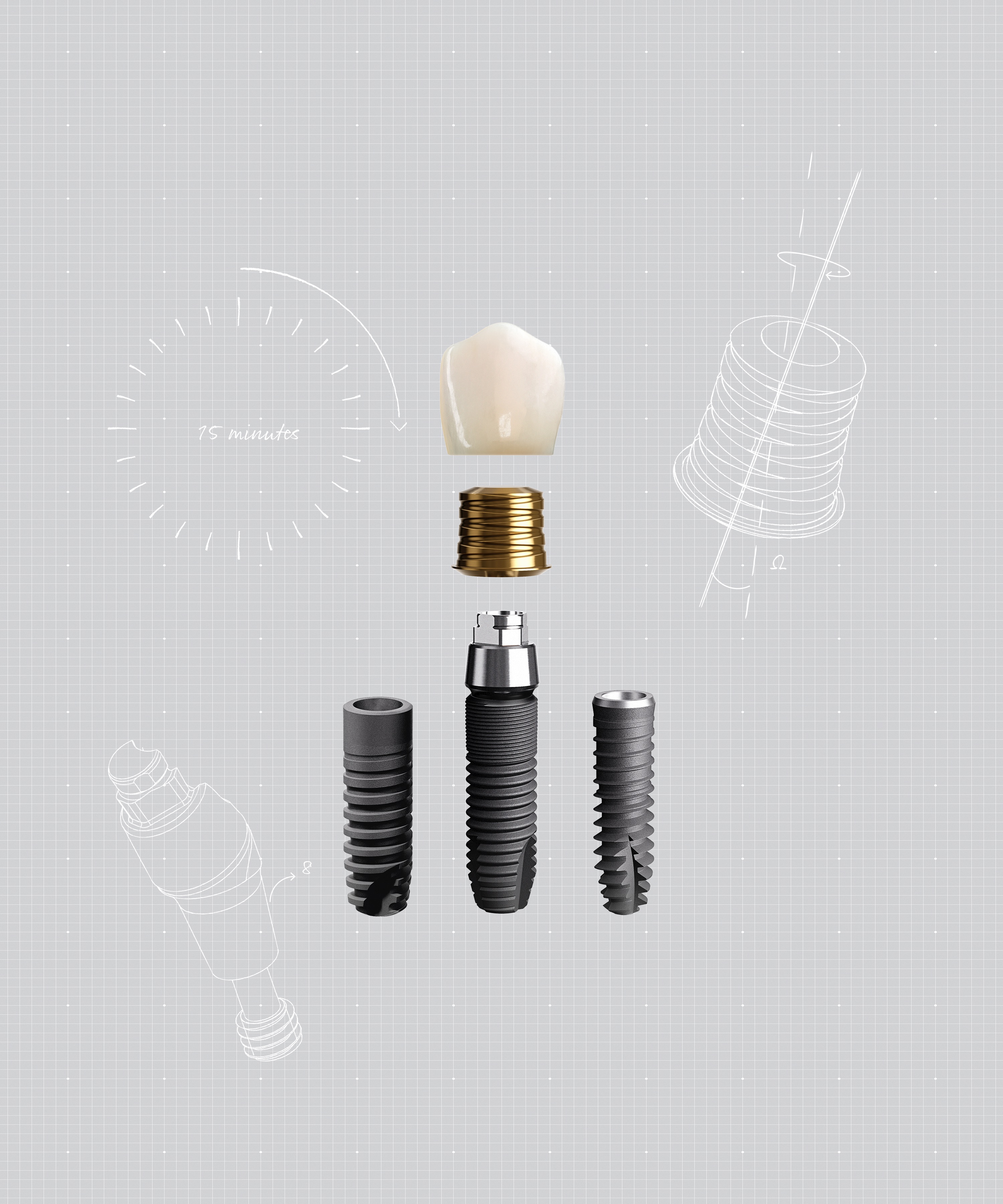 Acuris se basa en un concepto conométrico que emplea la fricción en lugar de un tornillo o cemento para fijar la corona y el casquillo al pilar en la parte protésica definitiva del tratamiento con implantes. FOTO: Dentsply Sirona