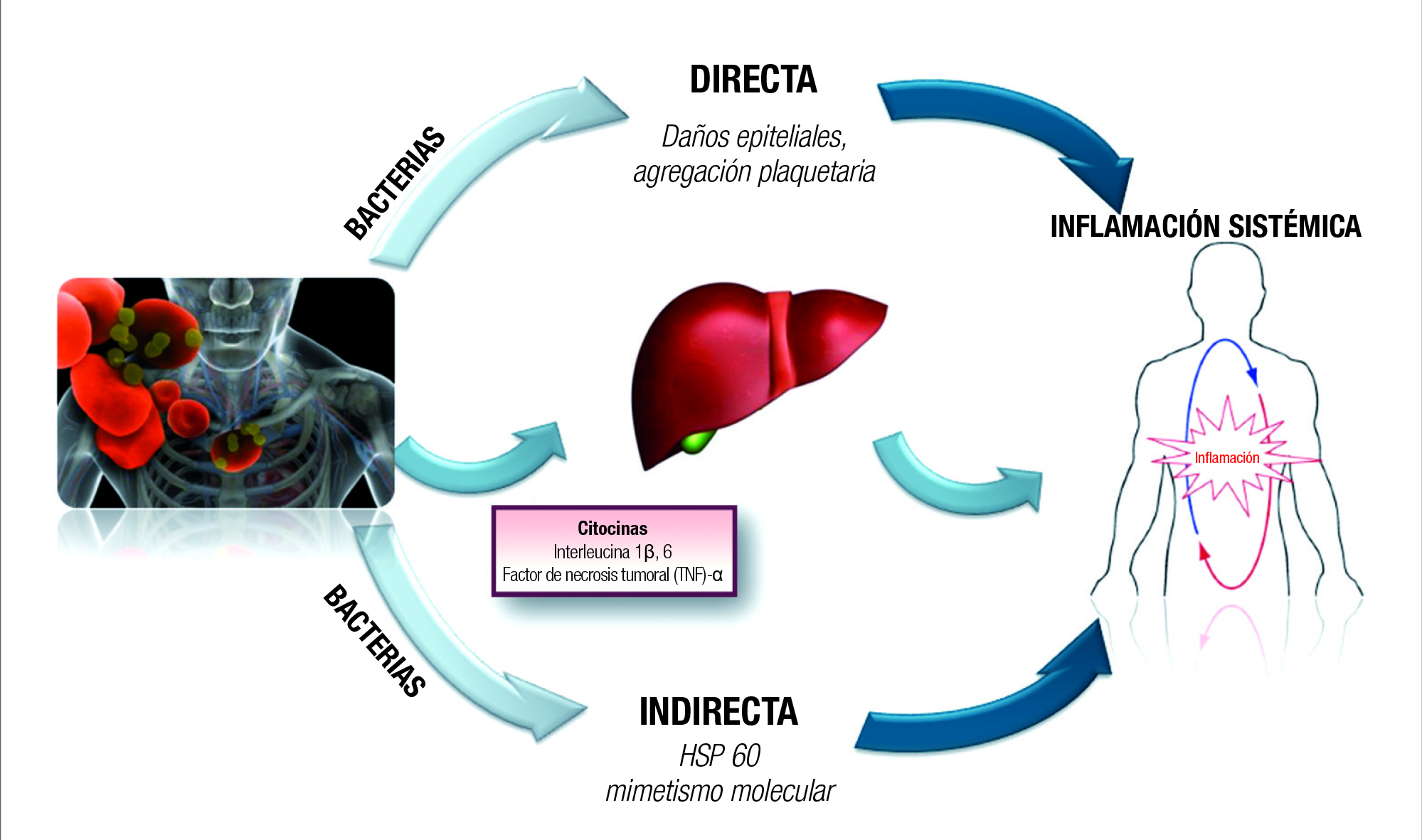 Figura 1. Mecanismos plausibles que explican la asociación entre periodontitis y enfermedades cardiovasculares.