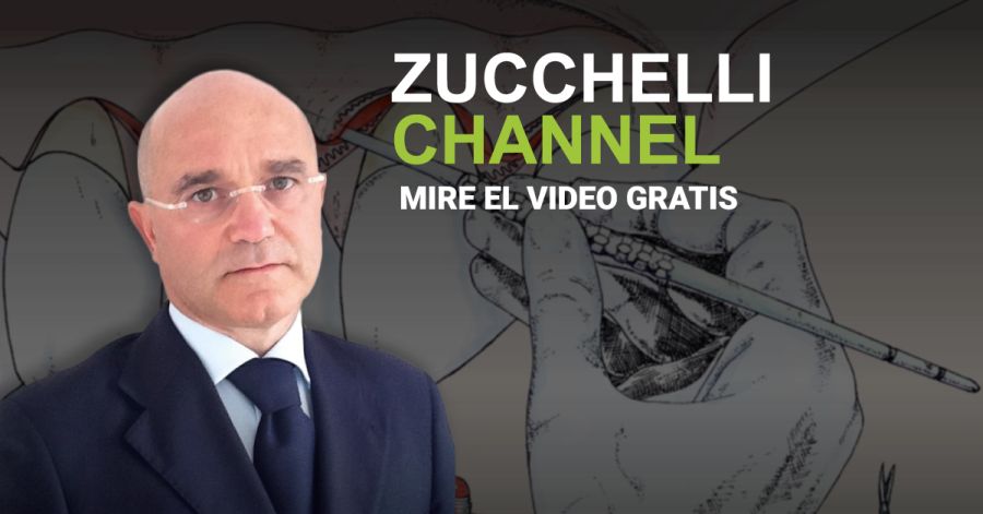 Zuchelli Channel.
