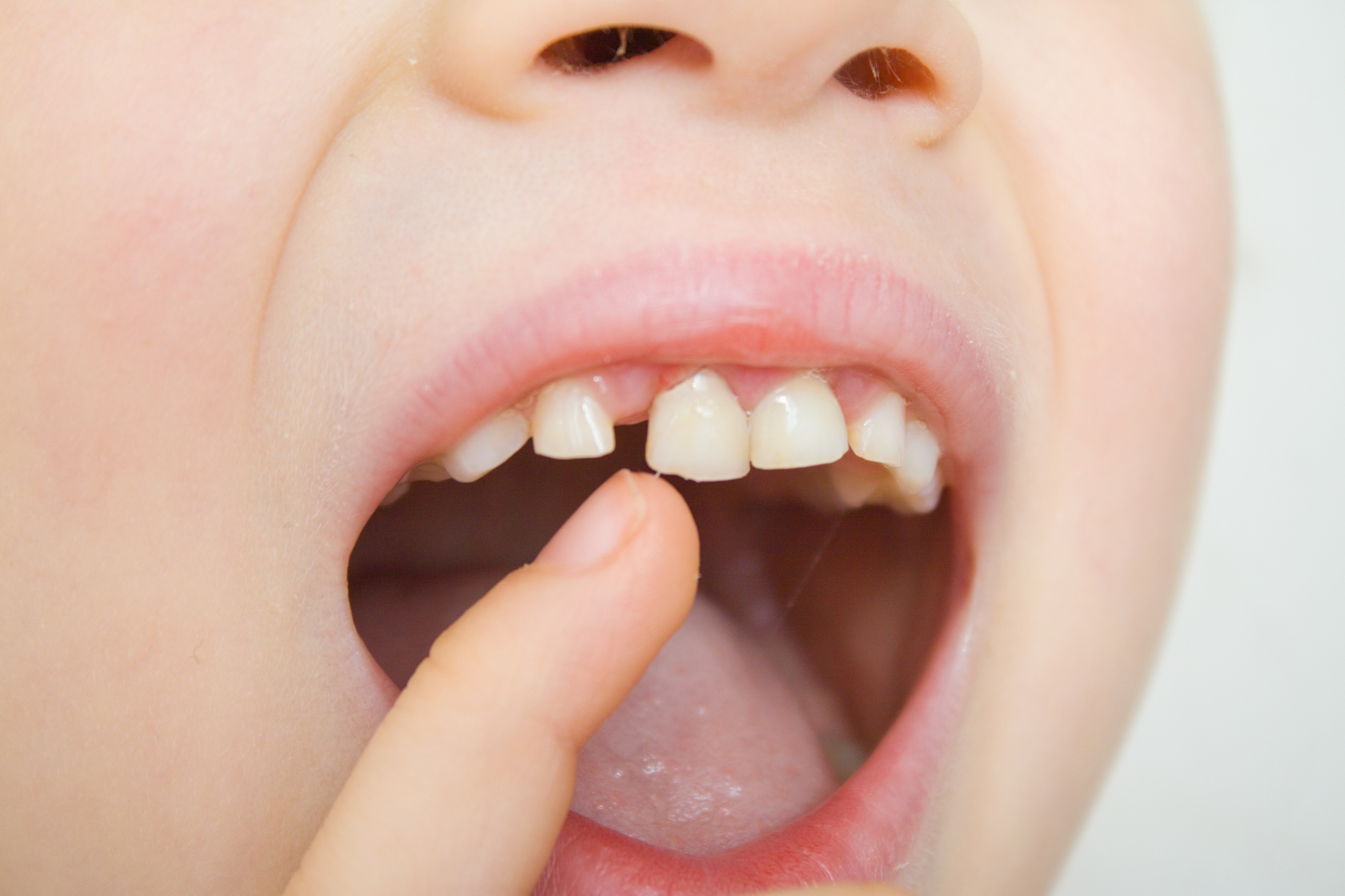 La RNO tiene como objetivo reequilibrar la boca para mantener su salud y la del resto del organismo. FOTO: CSD