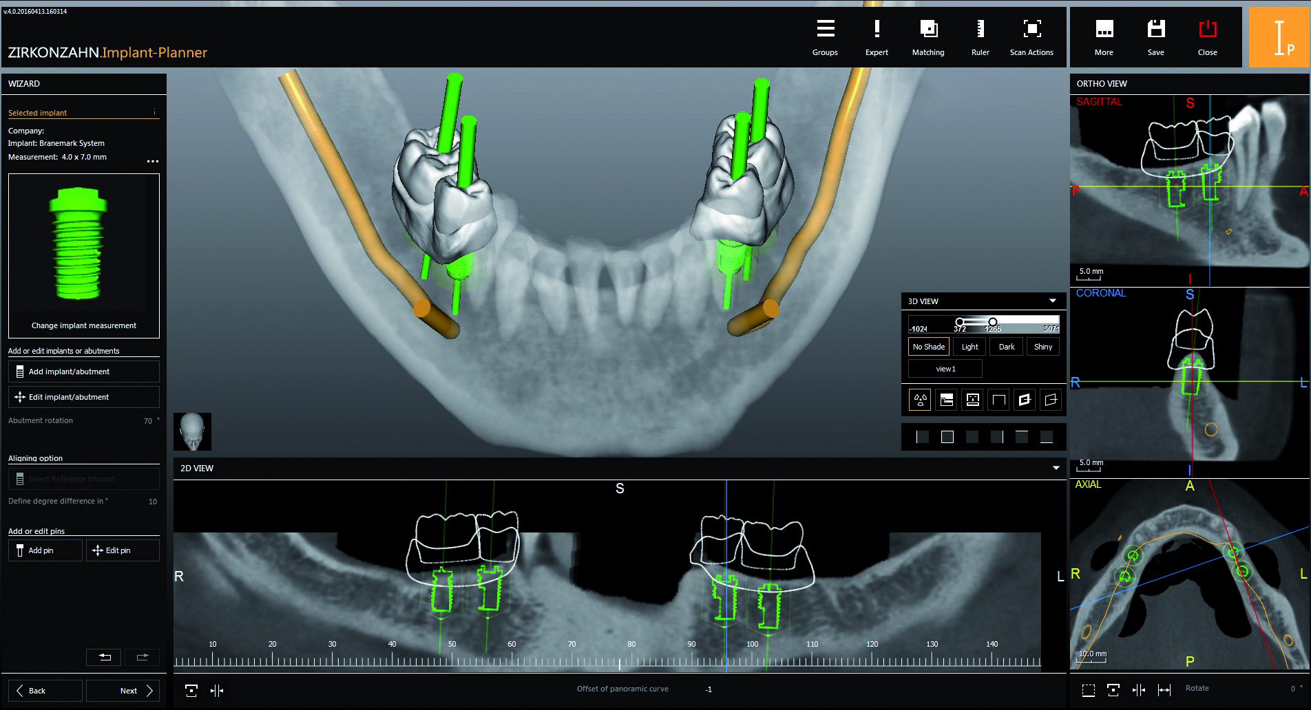 En la imagen, el Implant-Planner de Zirkonzahn. FOTO: Zirkonzahn