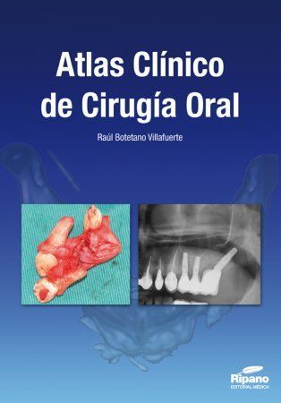 Atlas Clínico de Cirugía Oral