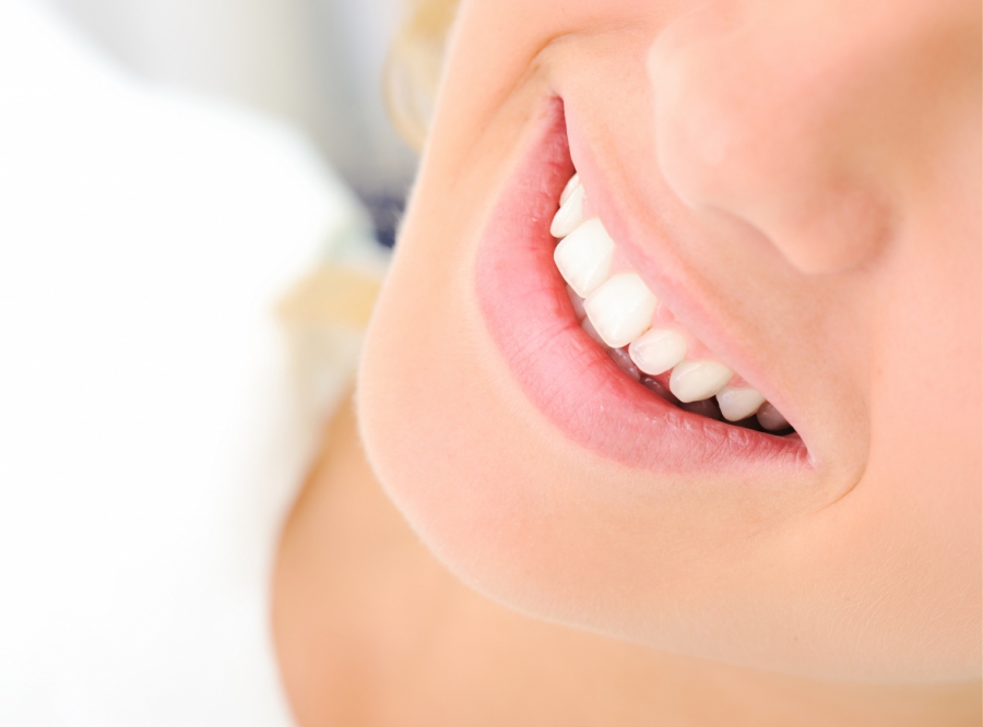 En los últimos años, el blanqueamiento dental se ha convertido en uno de los tratamientos más solicitados en las clínicas odontológicas. FOTO: Consejo General de Dentistas