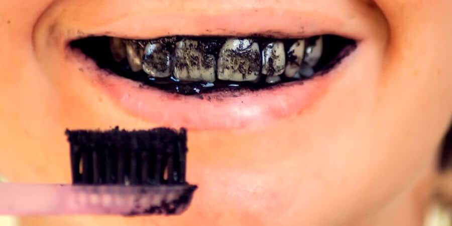 El carbón activado tiene una gran capacidad abrasiva y su uso puede suponer graves problemas en los dientes y en las encías. FOTO: Consejo General de Dentistas
