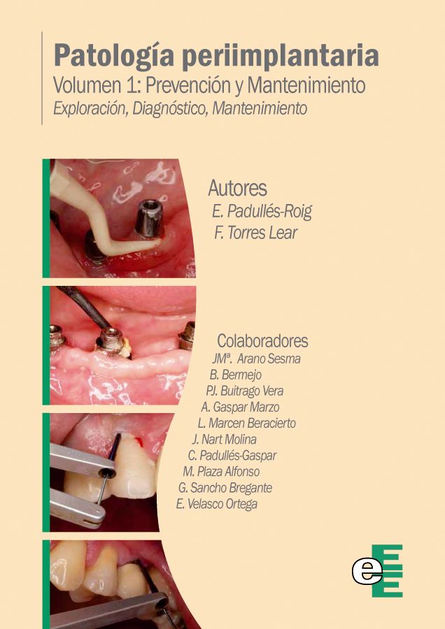 La obra “Patología periimplantaria” está compuesta por dos volúmenes y tiene prevista su aparición en enero 2014.