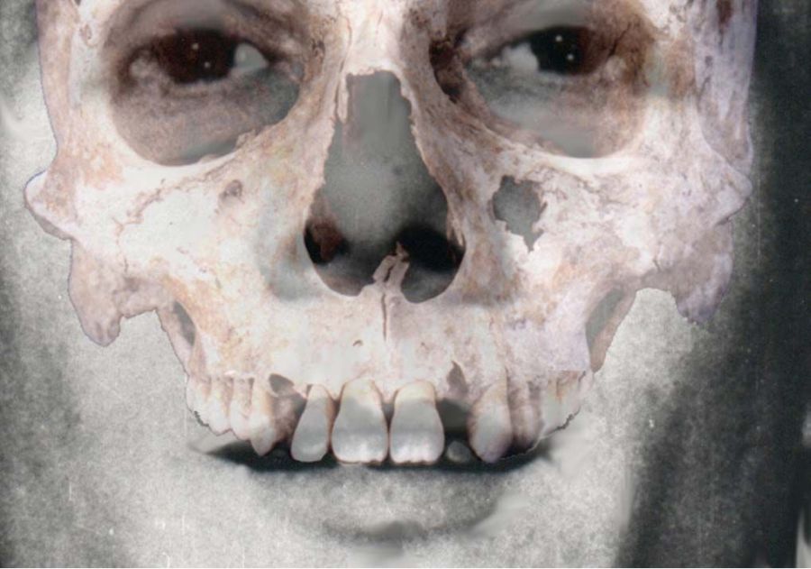 La visión de dientes ante-mortem permite obtener resultados positivos al comparar con el cráneo de un cadáver, superponiendo los dientes.